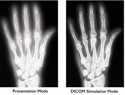 LU950 Dicom Mode